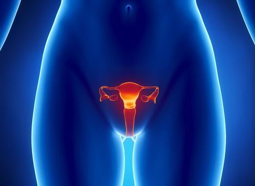 GYNPlus - Cáncer de útero y ovario