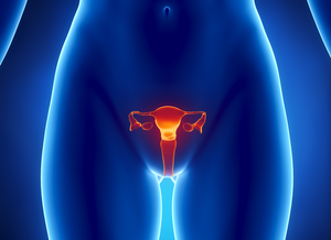 GYNPlus - Cáncer de útero y ovario